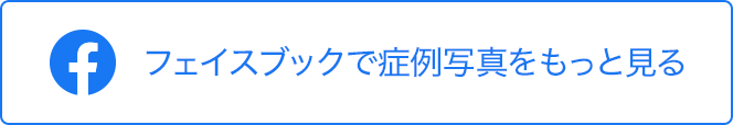 フェイスブックで症例写真をもっと見る
