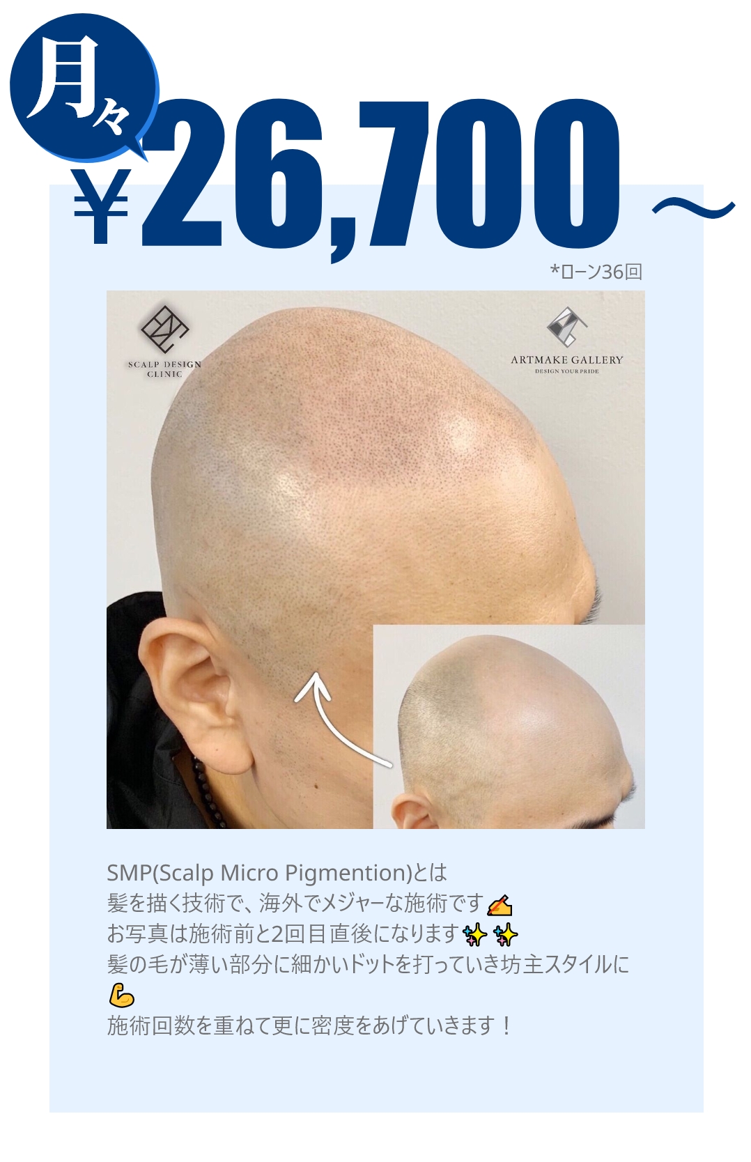月々26,700円～