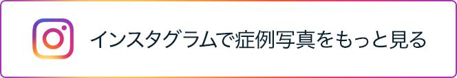 インスタグラムで症例写真をもっと見る
